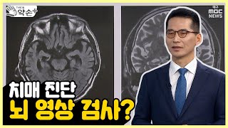 치매 진단 방법은 건강한 노년을 위한 ‘치매’ 바로 알기 ⑧  메디컬 약손 [upl. by Peace518]