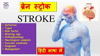 what is stroke full video in Hindi explore stroke brain braintest ischemicstroke [upl. by Kinney684]