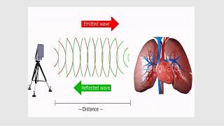 Robust mmWave Radar Based Heart and Breathing Rate Monitoring [upl. by Atlanta]