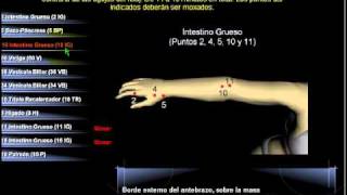 Tratamiento de la Artrosis y Artritis de hombro con digitopuntura [upl. by Adnale]