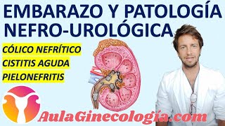 EMBARAZO Y PATOLOGÍA UROLÓGICA CÓLICO CISTITIS PIELONEFRITIS  Ginecología y Obstetricia [upl. by Downall298]