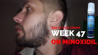 Minoxidil Beard  Week 47  Minoxidil 5 for Beard Growth  Facialfuzzfridays [upl. by Mya269]