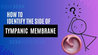 Learn how to identify the side of the tympanic membrane 😊 [upl. by Dominic79]