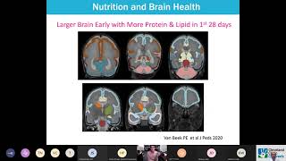 Brain Development in the Preterm Newborn [upl. by Regine]