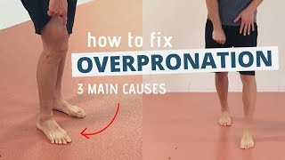 Pronated Feet and How to Fix 3 Different Causes of OVERPRONATION [upl. by Sulamith]