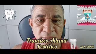 🇧🇷 Francisco Ademir Protético Pra deixar seu sorriso mais bonito [upl. by Lester69]