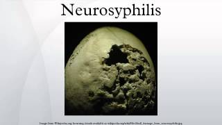 Neurosyphilis [upl. by Rurik597]