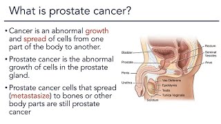 Prostate Cancer Overview [upl. by Lettie253]