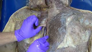 From Grant’s Dissection Video Collection Superficial Muscles of the Back [upl. by Teddie]