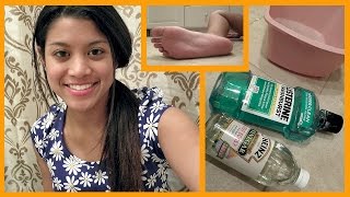 DIY Dry Foot Remedy Review [upl. by Trik]