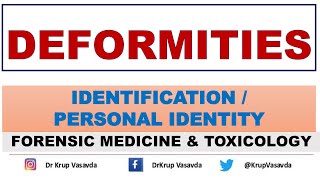 Deformities  Identification  Dr Krup Vasavda [upl. by Tumer]