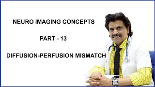 NEURO IMAGING CONCEPTS PART  13 DIFFUSION PERFUSION MISMATCH [upl. by Kevon264]