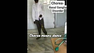 Chorea Movement Disorder mbbs neetpg next [upl. by Bolling809]