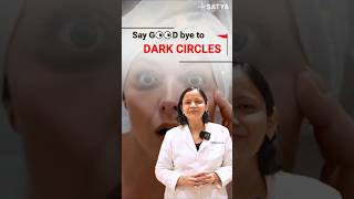 What are the causes of Dark under eye circles darkcircles undereyedarkcircles dermatologist [upl. by Llekram]