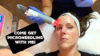 My Vivace Microneedling Experience  Full Three Month Update [upl. by Pardo302]