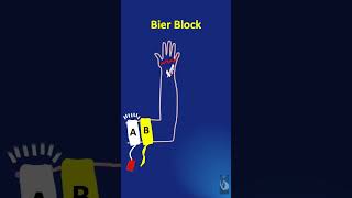 Shorts  56 Bier Block Part 3 How is a Bier Block given What is the sequence of events and steps [upl. by Bodi]