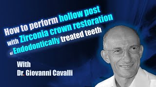 How to perform hollow post with Zirconia crown restoration of Endodontically treated teeth [upl. by Garnett]