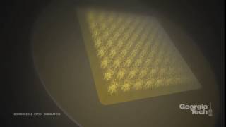 Simulation of the microneedle patch for flu vaccination [upl. by Tymes420]