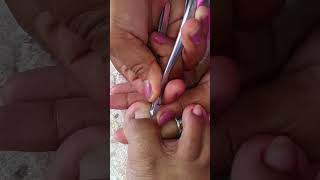 Removing ingrown toenail trending manicure [upl. by Mcknight493]