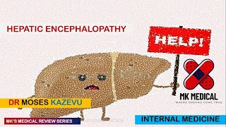 Hepatic encephalopathy [upl. by Shannen]