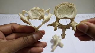 Vertebrae  Identification Features amp Differences [upl. by Alexio]