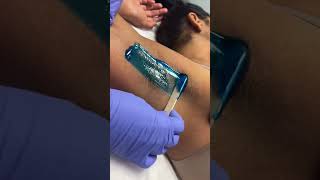 Quick professional underarm wax using hard blue wax from Starpil professional Esthetician [upl. by Enautna917]