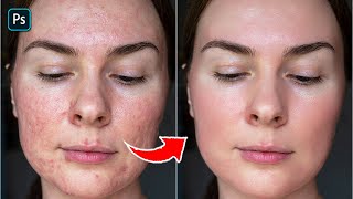 3Minutes Photoshop  Achieve Stunning Skin Retouching and Texture Effects  Photoshop Tutorial [upl. by Norahc]