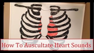 How To Auscultate Heart Sounds [upl. by Bone]