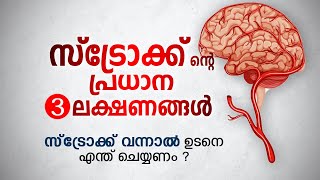 സ്ട്രോക്ക് ന്റെ പ്രധാന 3 ലക്ഷണങ്ങൾ  സ്ട്രോക്ക് വന്നാൽ ഉടനെ എന്ത് ചെയ്യണം  Stroke Symptoms [upl. by Ilil]