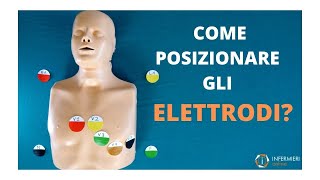 COME POSIZIONARE GLI ELETTRODI PER LECG A 12 DERIVAZIONI  INFERMIERI online [upl. by Kirsti275]