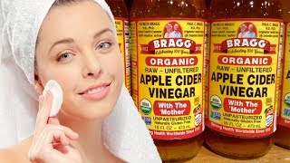 Here is What Happens When You Wash Your Face With Apple Cider Vinegar [upl. by Ettennil879]