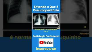 Entenda o Que é Pneumoperitônio shorts tecnologoemradiologia amigosdaradiologia anatomia [upl. by Hank]