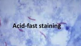 Respiratory microbiology  Acid fast staining microbiology staining mycobacteria [upl. by Aidan625]