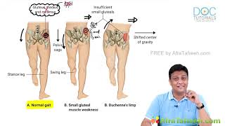 Anatomy lower limb gluteal region gluteal muscles [upl. by Ulrica]