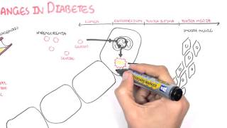 Diabetes Complication and Pathophysiology of the complication [upl. by Attenreb]