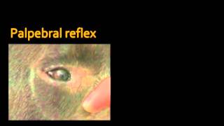 Palpebral and corneal reflexes [upl. by Simaj]