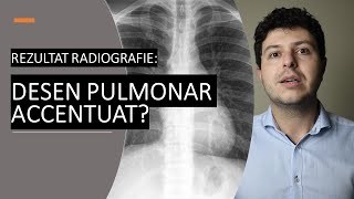 Ce înseamnă desen pulmonar accentuat pe radiografie [upl. by Lotson]