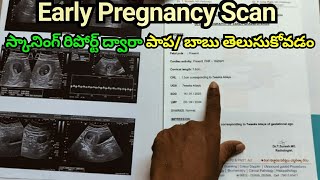 Early Pregnancy Scan  How To Read Pregnancy Scan Report  Pregnancy Scan  Pregnancy Journey [upl. by Marsden]