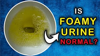 Is it NORMAL to have a FOAMY URINE Cause and Treatment [upl. by Htedirem]