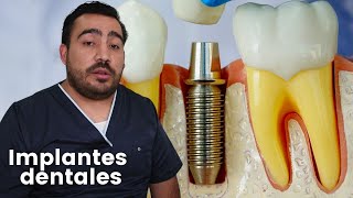 Precio de los IMPLANTES dentales  ¿Cuánto cuestan  Shorts [upl. by Rofotsirk]