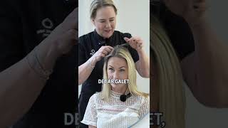 Fungerar en hårtransplantation på en ärrvävnad nordichairclinic hårtransplantation [upl. by Nove537]