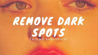 Ｒｅｍｏｖｅ Ｄａｒｋ Ｓｐｏｔｓ ｜Ｆｏｒｃｅｄ Ｓｕｂｌｉｍｉｎａｌ （ｉｍｐｒｏｖｅｄ） [upl. by Tallu]