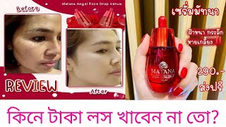 matana serum review উপকারিকা কি কি জানুন khadija begum what is serum Shahnaz shimul shimmer girl [upl. by Ater424]