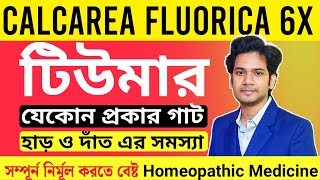 Calcarea Fluorica 6x  Calcarea Fluorica 12x Homeopathic Medicine  টিউমার হোমিওপ্যাথি চিকিৎসা [upl. by Yesdnyl]