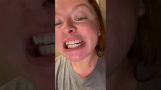 Baking soda and hydrogen peroxide teeth whitening at home teethwhitening teeth diy beauty 🤍 [upl. by Deraj]