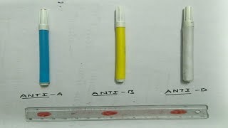 Determination of blood group [upl. by Llertnauq1]