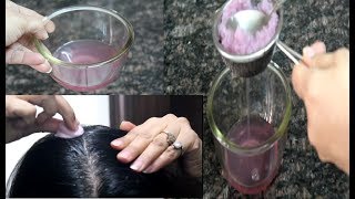 How To Use Onion Juice For Hair RegrowthDandruff Hair fall Control Premature Greying Of Hair [upl. by Va]