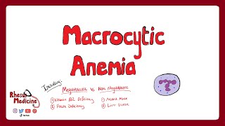 MACROCYTIC ANEMIA  Megaloblastic Anemia Vitamin B12 and Folate Deficiency  Rhesus Medicine [upl. by Acirema489]