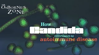 How Candida Contributes to Autoimmune Disease  Dr Osbornes Zone [upl. by Rik]