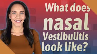 What does nasal Vestibulitis look like [upl. by Letsyrk]